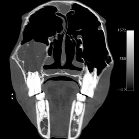 A equine computed tomography scan